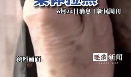 爆料残疾母子视频播放网站,残疾母子视频播放网站引发社会关注